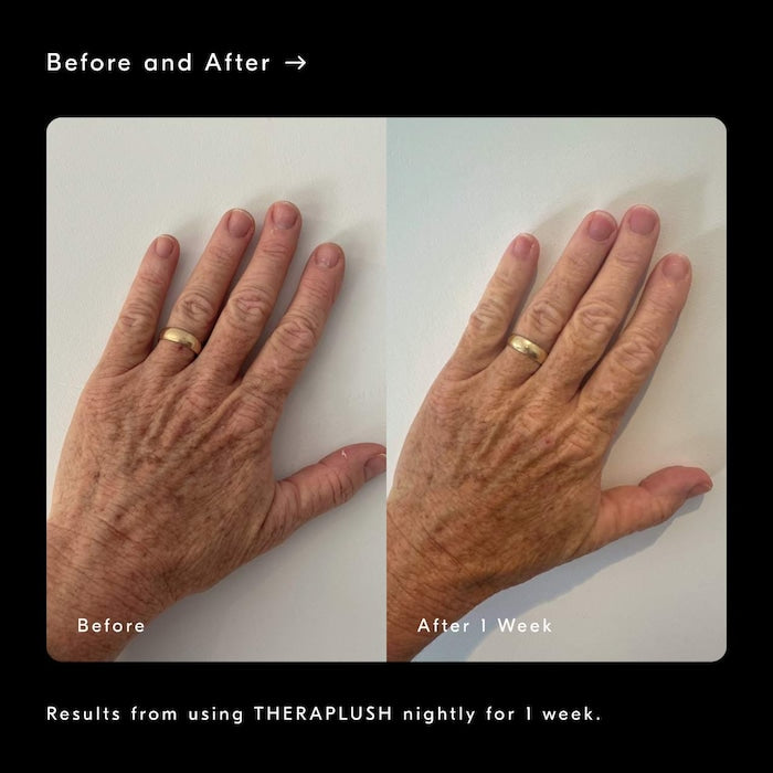 Theraplush “Hold” Refillable Overnight Retinol Hand Repair Cream
