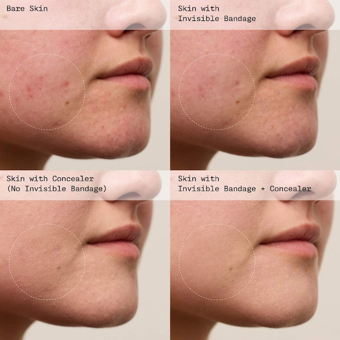 INVISIBLE BANDAGE Protect + Prime Solution Gel with Niacinamide