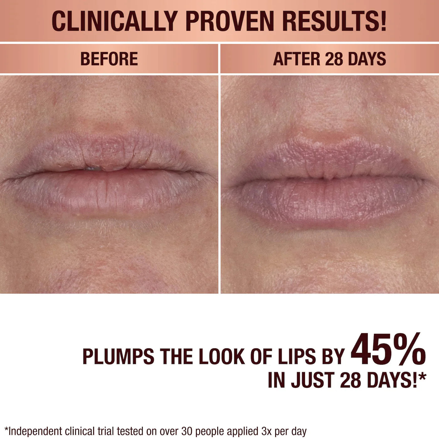 💋 Life Changing Lip Mask – Charlotte Tilbury