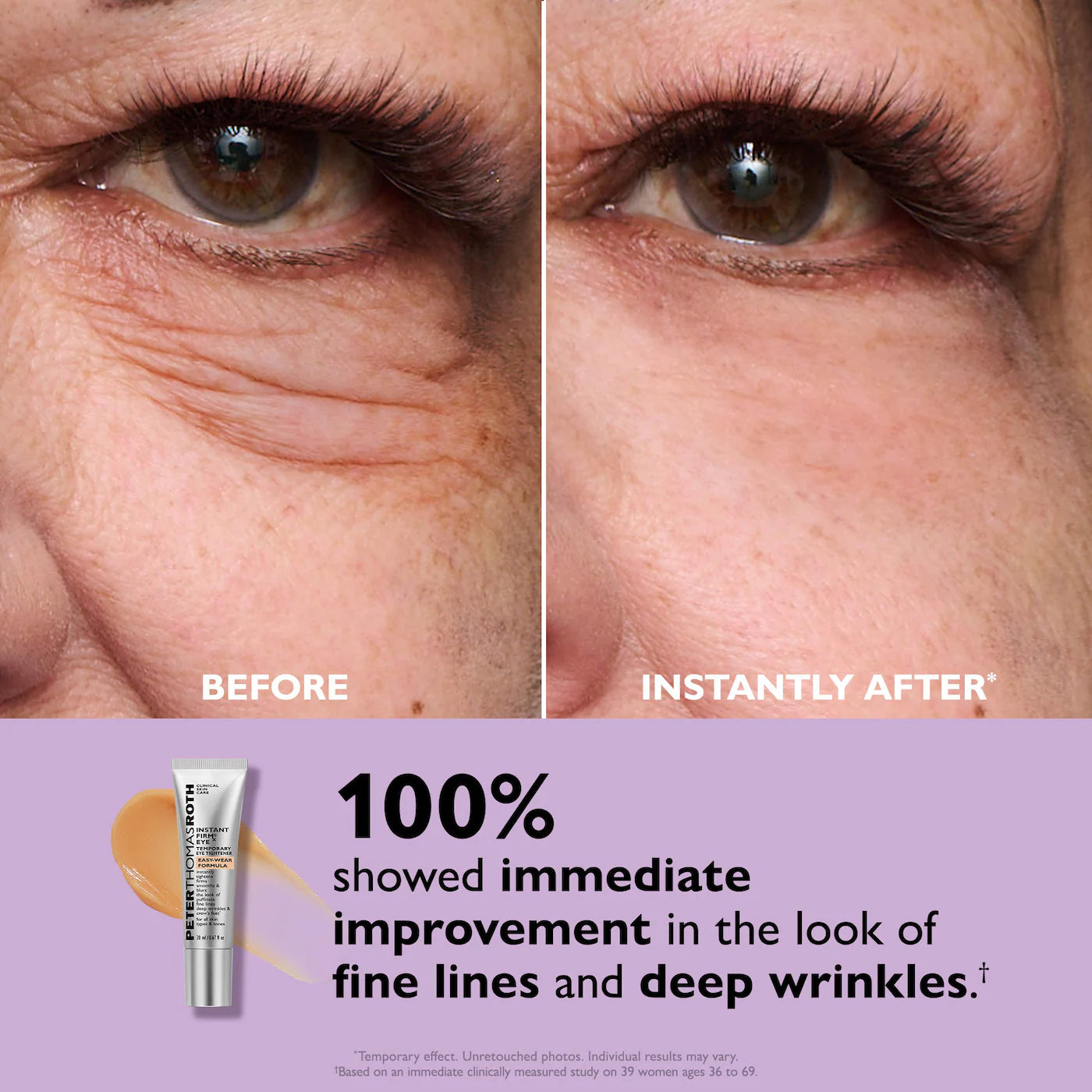Peter Thomas Roth – Instant FIRMx® Eye (Easy-Wear)