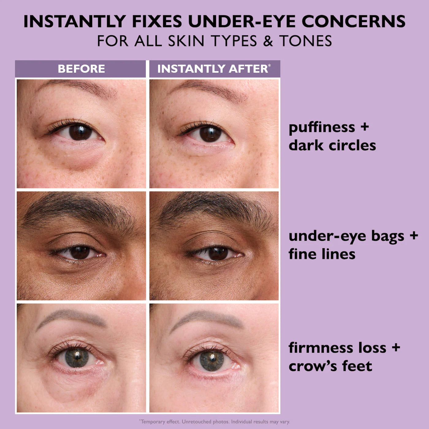 Peter Thomas Roth – Instant FIRMx® Eye (Easy-Wear)