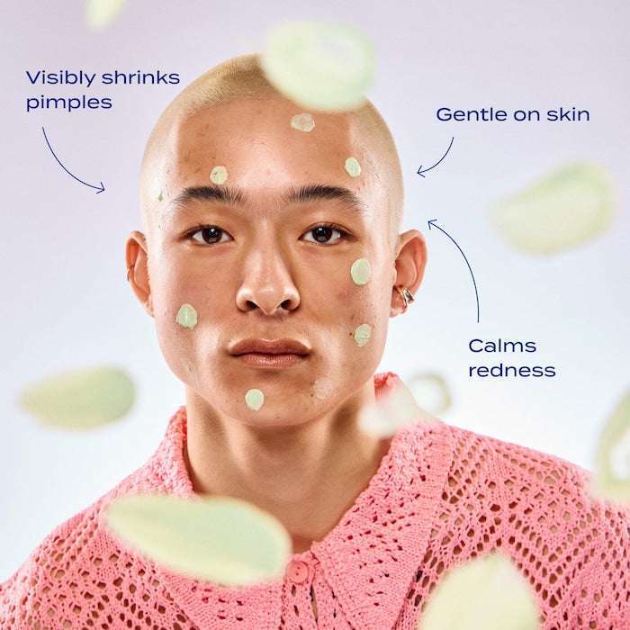 Sulfur Spot Treatment for Acne and Blemishes